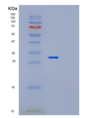 Recombinant Human MED4 Protein,Recombinant Human MED4 Protein