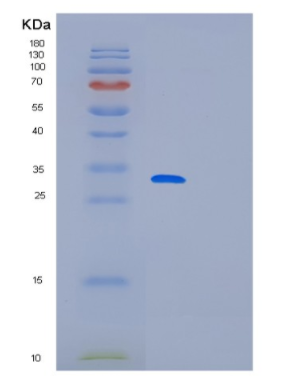 Recombinant Human MED7 Protein,Recombinant Human MED7 Protein