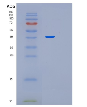 Recombinant Human MEIS3 Protein,Recombinant Human MEIS3 Protein