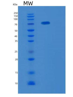 Recombinant Mouse Mep1b Protein,Recombinant Mouse Mep1b Protein