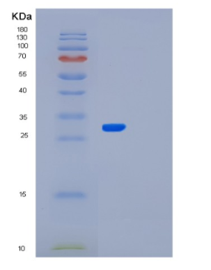 Recombinant Mouse Meteorin Protein,Recombinant Mouse Meteorin Protein