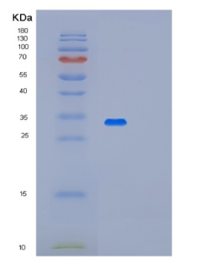 Recombinant Human METTL1 Protein,Recombinant Human METTL1 Protein