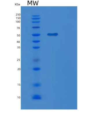 Recombinant Human MGAT2 Protein,Recombinant Human MGAT2 Protein