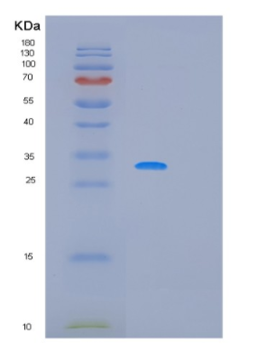 Recombinant Human MFAP4 Protein,Recombinant Human MFAP4 Protein