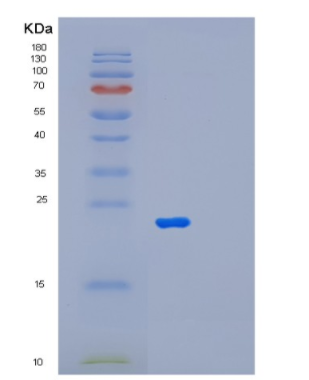 Recombinant Human MFAP2 Protein,Recombinant Human MFAP2 Protein