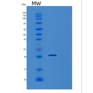 Recombinant Human KLRB1 Protein