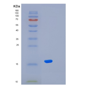 Recombinant Human KLRG1 Protein