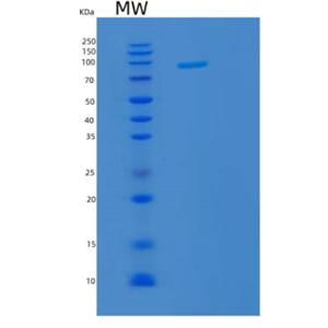 Recombinant Human KPNB1 Protein,Recombinant Human KPNB1 Protein