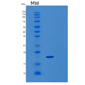 Recombinant Human KLRC2 Protein,Recombinant Human KLRC2 Protein