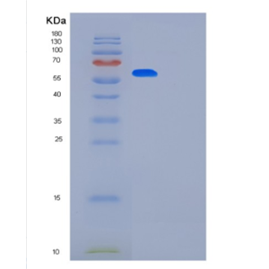 Recombinant Human KPNA2 Protein,Recombinant Human KPNA2 Protein