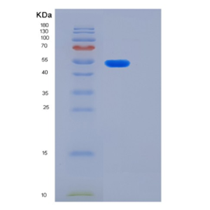 Recombinant Human KRT14 Protein,Recombinant Human KRT14 Protein