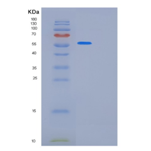 Recombinant Human KRT8 Protein,Recombinant Human KRT8 Protein