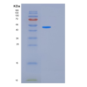 Recombinant Human KRT20 Protein,Recombinant Human KRT20 Protein