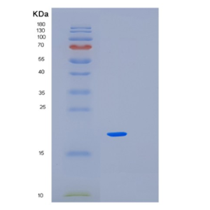 Recombinant Human KLRK1 Protein