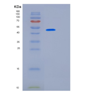 Recombinant Human KRT17 Protein,Recombinant Human KRT17 Protein