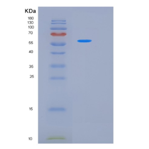 Recombinant Human LAP3 Protein