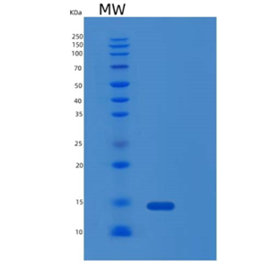 Recombinant Human LAMTOR4 Protein,Recombinant Human LAMTOR4 Protein