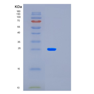 Recombinant Human LAYN Protein,Recombinant Human LAYN Protein