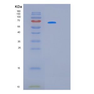 Recombinant Human KRT5 Protein,Recombinant Human KRT5 Protein