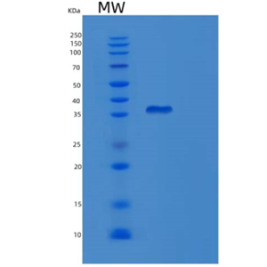 Recombinant Human LDHB Protein,Recombinant Human LDHB Protein