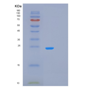 Recombinant Human LAT Protein,Recombinant Human LAT Protein