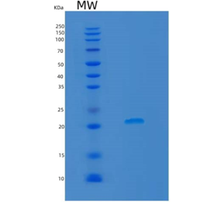 Recombinant Rat Lcn2 Protein