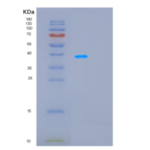 Recombinant Rat Ldha Protein