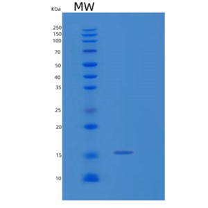 Recombinant Human LECT1 Protein,Recombinant Human LECT1 Protein