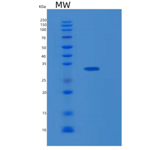 Recombinant Human LASP1 Protein,Recombinant Human LASP1 Protein