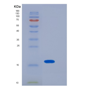 Recombinant Mouse LGALS1 Protein,Recombinant Mouse LGALS1 Protein