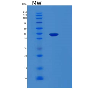 Recombinant Human LGALS8 Protein