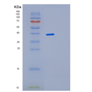 Recombinant Mouse Lgals4 Protein,Recombinant Mouse Lgals4 Protein