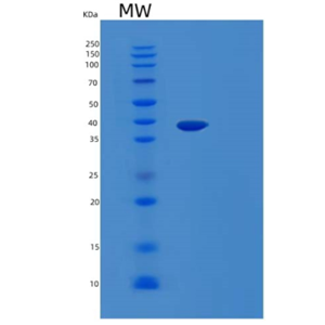 Recombinant Mouse LGALS9 Protein,Recombinant Mouse LGALS9 Protein