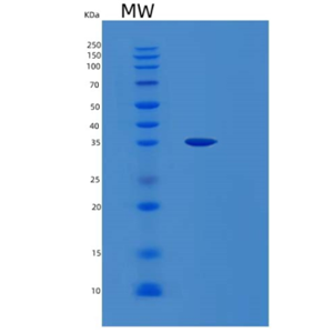 Recombinant Human LHPP Protein,Recombinant Human LHPP Protein