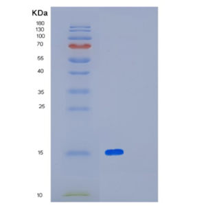 Recombinant Human Leukocyte surface antigen CD47 Protein