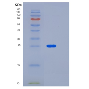 Recombinant Mouse LDLR chaperone MESD Protein,Recombinant Mouse LDLR chaperone MESD Protein