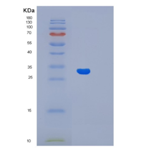 Recombinant Human Lin7A Protein,Recombinant Human Lin7A Protein