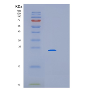 Recombinant Human LIN7C Protein,Recombinant Human LIN7C Protein