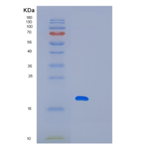 Recombinant Human LITAF Protein,Recombinant Human LITAF Protein