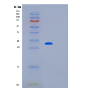 Recombinant Human LOX Protein,Recombinant Human LOX Protein