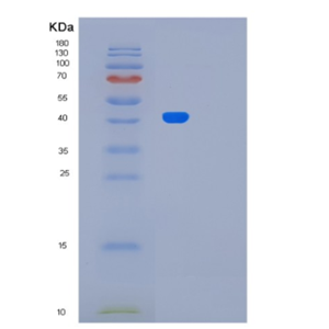 Recombinant Human LRP2BP Protein,Recombinant Human LRP2BP Protein