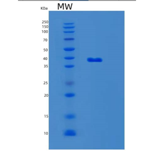 Recombinant Mouse LGALS8 Protein
