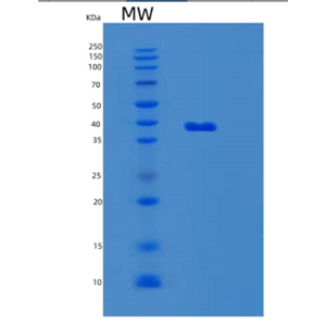 Recombinant Mouse LGALS8 Protein,Recombinant Mouse LGALS8 Protein