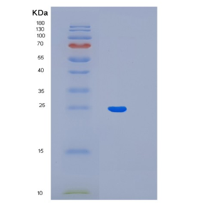 Recombinant Human LIN7B Protein,Recombinant Human LIN7B Protein