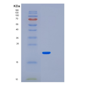 Recombinant Human LMO1 Protein