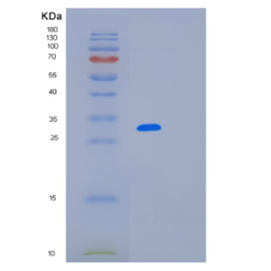 Recombinant Human LRRC59 Protein