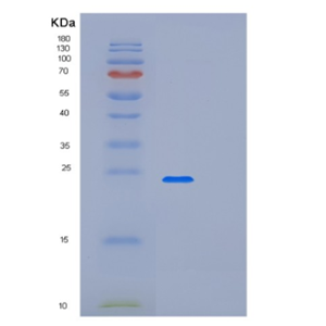 Recombinant Human LSM12 Protein