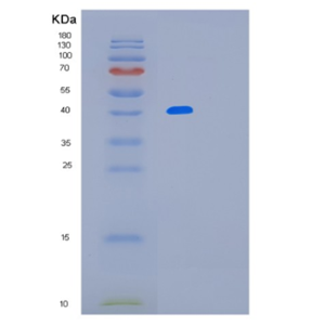 Recombinant Mouse Lrpap1 Protein