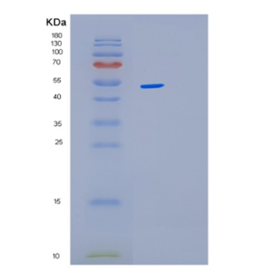 Recombinant Human LPCAT1 Protein