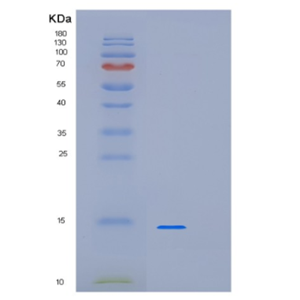 Recombinant Human LSM3 Protein